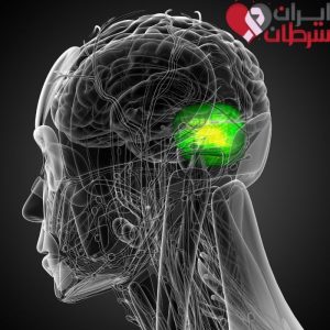 تومور مخچه