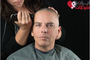 پیش از جراحی تومور مغزی