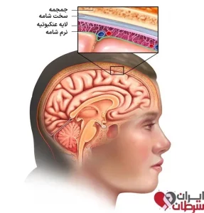 لایه های مننژ