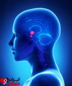 تومور های هیپوفیز