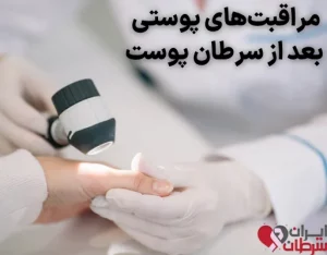 مراقبت‌ های پوستی بعد از سرطان پوست